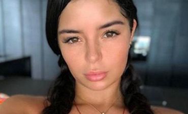 22 yaşlı model cəsarəti ilə heyran edir - FOTO